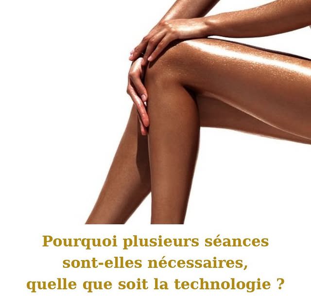 Pourquoi plusieurs séances sont nécessaires en épilation définitive